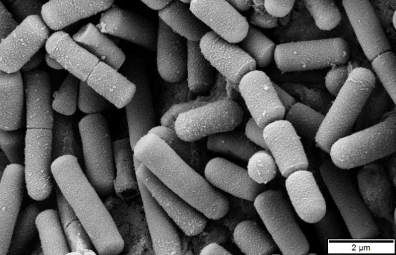 Что такое синдром жареного риса. Бактерии Baccilus cereus под микроскопом. Фото.