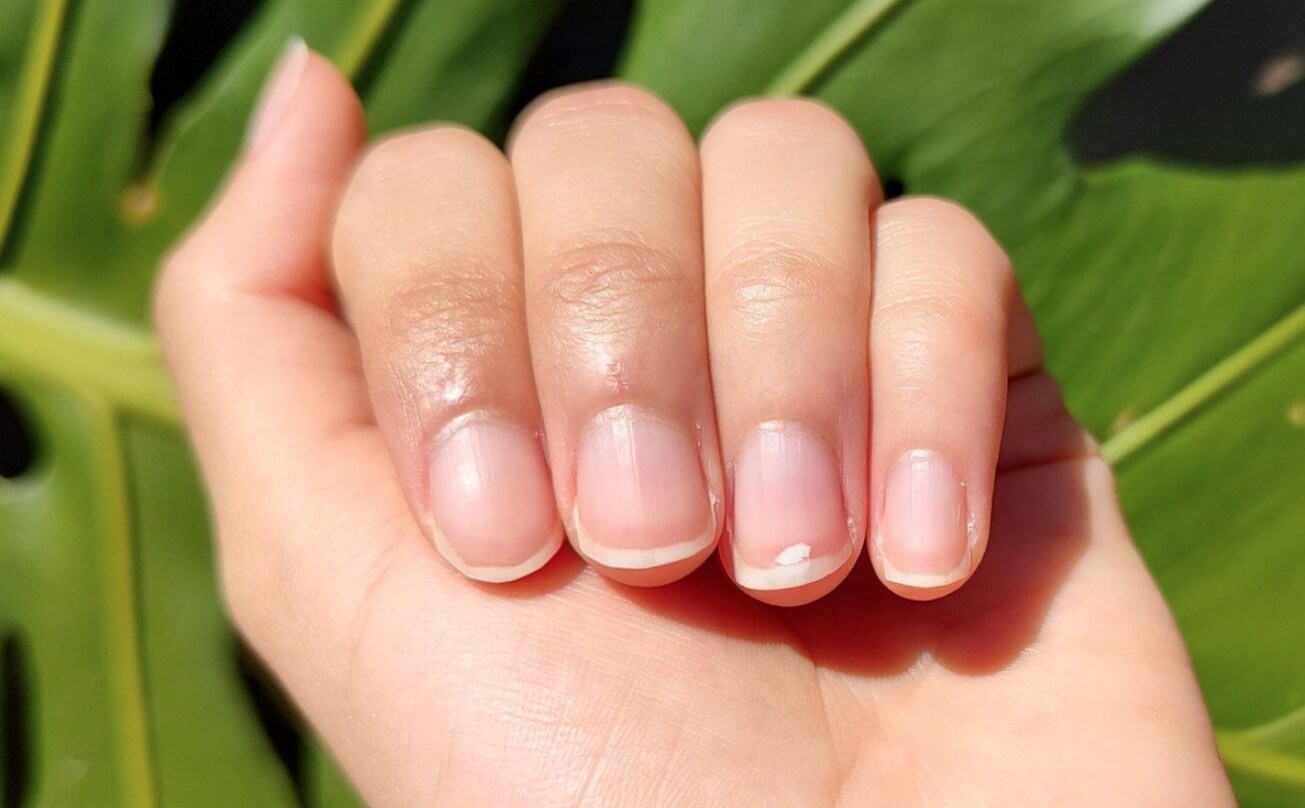 Что означают белые полосы на ногтях. Согласно примете, белые полосы на ногтях у детей — к счастью. Фото.