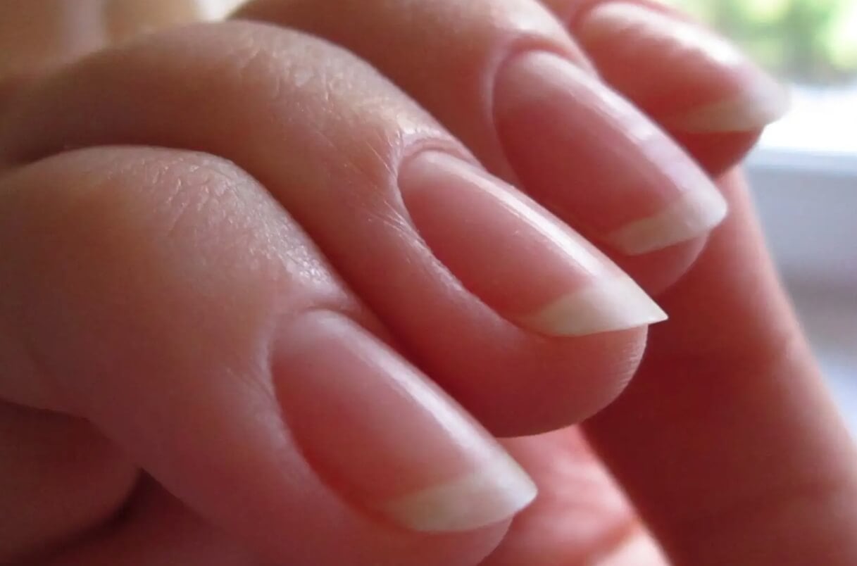 Из-за чего ногти бледные. Здоровые ногти человека имеют розовый цвет. Фото.