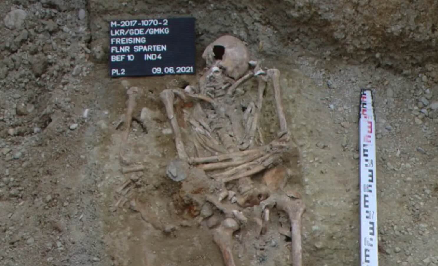Средневековый протез руки. Скелет средневекового человека с протезом руки. Фото.