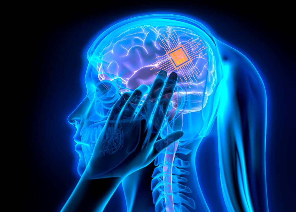 Ученые восстановили память при помощи имплантов. Чипы улучшили память и другие умственные способности участников эксперимента. Фото.