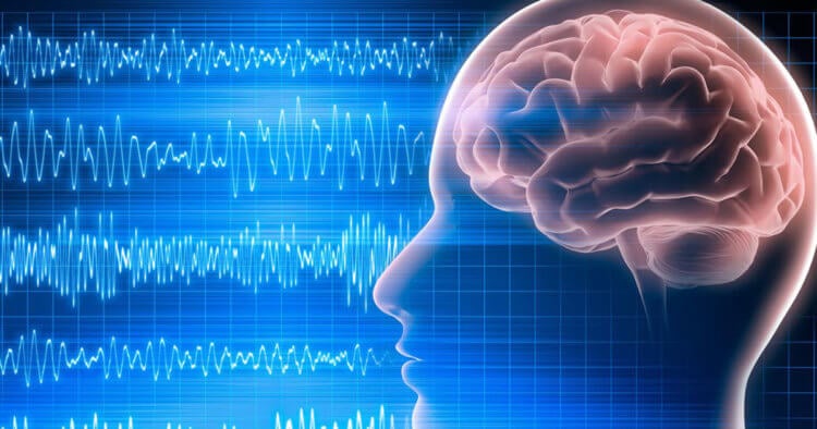 Почему замедление электрических колебаний помогает при депрессии. Электрошоковая терапия замедляет волны мозговой активности, которые видны на ЭЭГ. Фото.