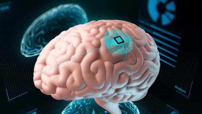 Ученые улучшили умственные способности человека при помощи чипа. Фото.