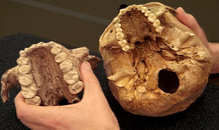 Чем питались неандертальцы. Зубы неандертальца. Фото.