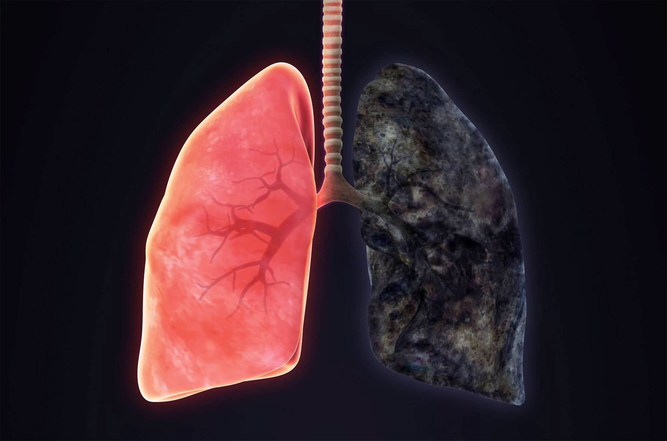 Что происходит с легкими из-за курения. Внешний вид здоровых и больных легких. Фото.