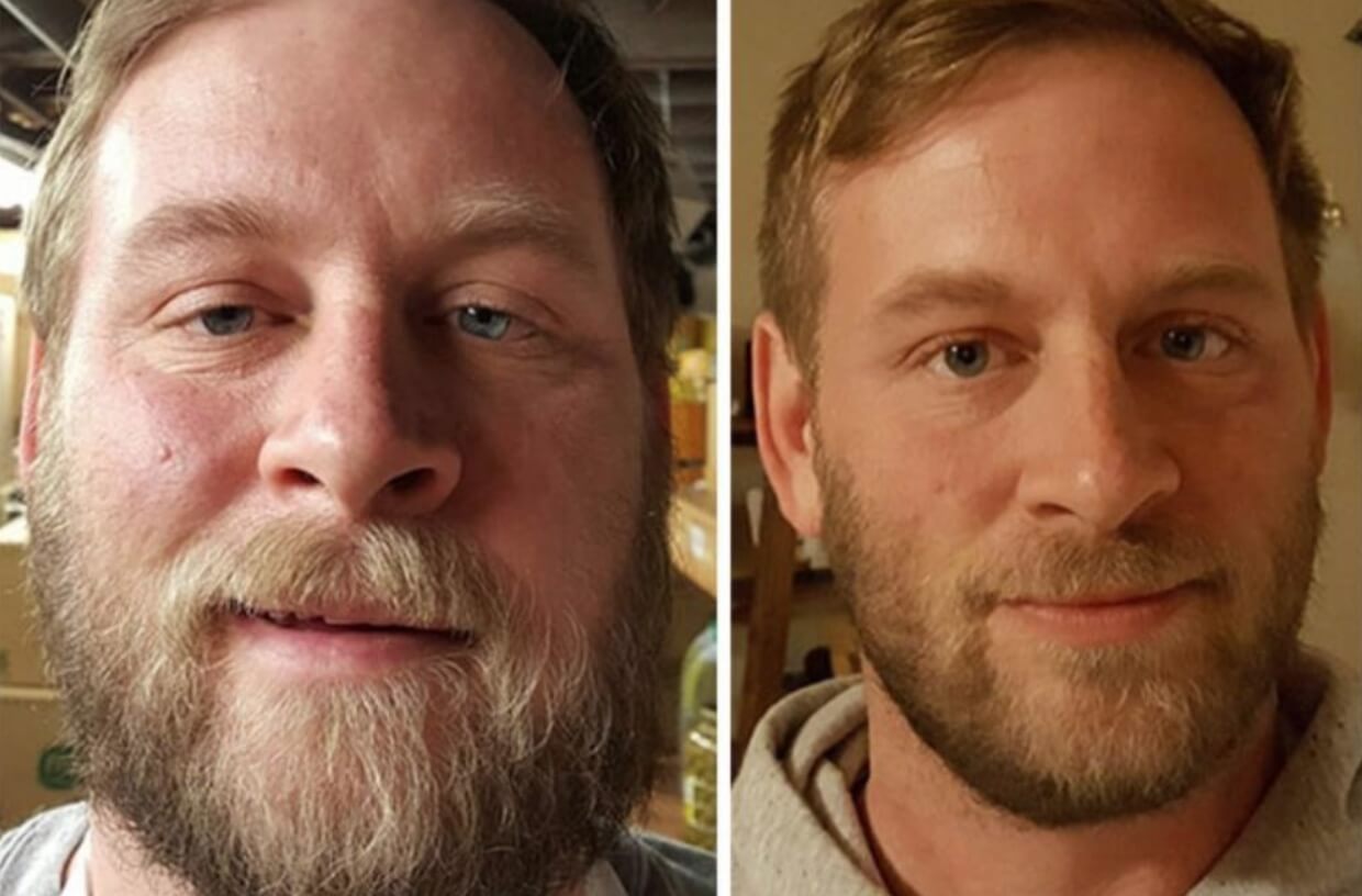 Человек до и после отказа от алкоголя. У бросившего алкоголь человека меняется даже взгляд. Фотография: Reddit. Фото.