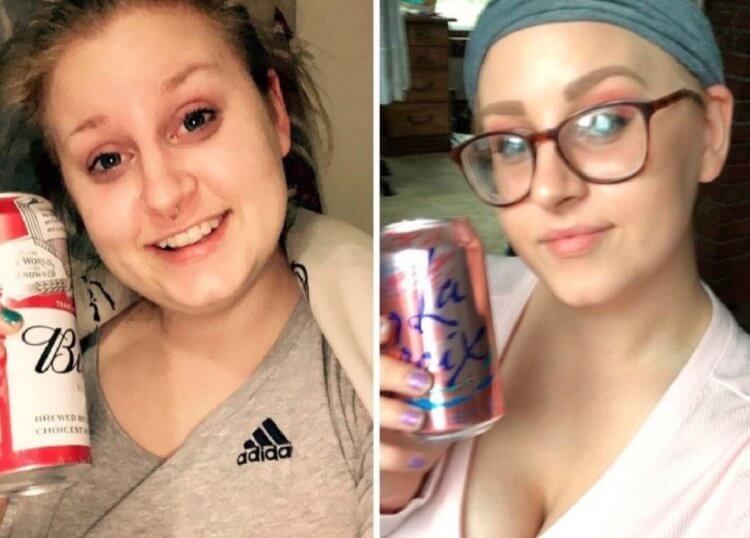 Человек до и после отказа от алкоголя. На этой фотографии отчетливо видно, как у девушки изменились очертания лица. Источник: Reddit. Фото.