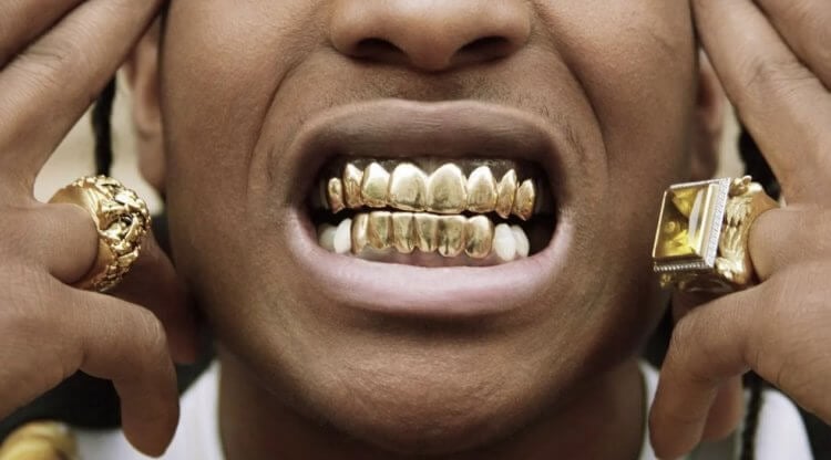 Минусы золотых зубов. В современном мире золотые зубы можно увидеть разве что у знаменитостей. Фото.