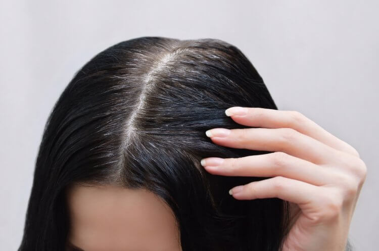 Почему люди рано седеют. Наблюдения показывают, что волосы также могут поседеть из-за стресса. Фото.