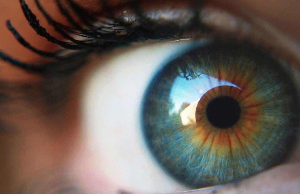 От чего зависит цвет глаз человека. Цвет глаз человека зависит от пигмента меланина. Фото.