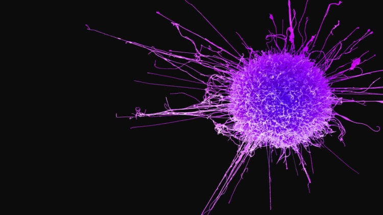 Понимание онкологических заболеваний. Уничтожить раковые клетки чрезвычайно сложно. Фото.