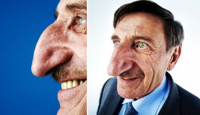 Почему у пожилых людей большие уши и носы — научное объяснение. Фото.
