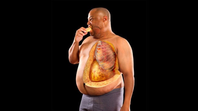 В мире насчитывается больше миллиарда людей с ожирением. Фото.