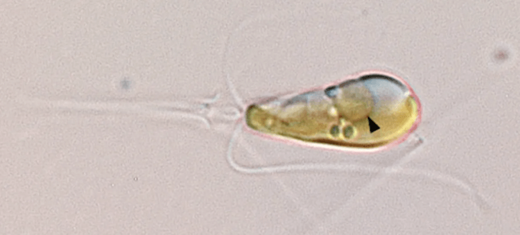Livet er opstået på Jorden igen. En tangcelle med en ny organel, nitroplast (angivet med en pil). Foto.