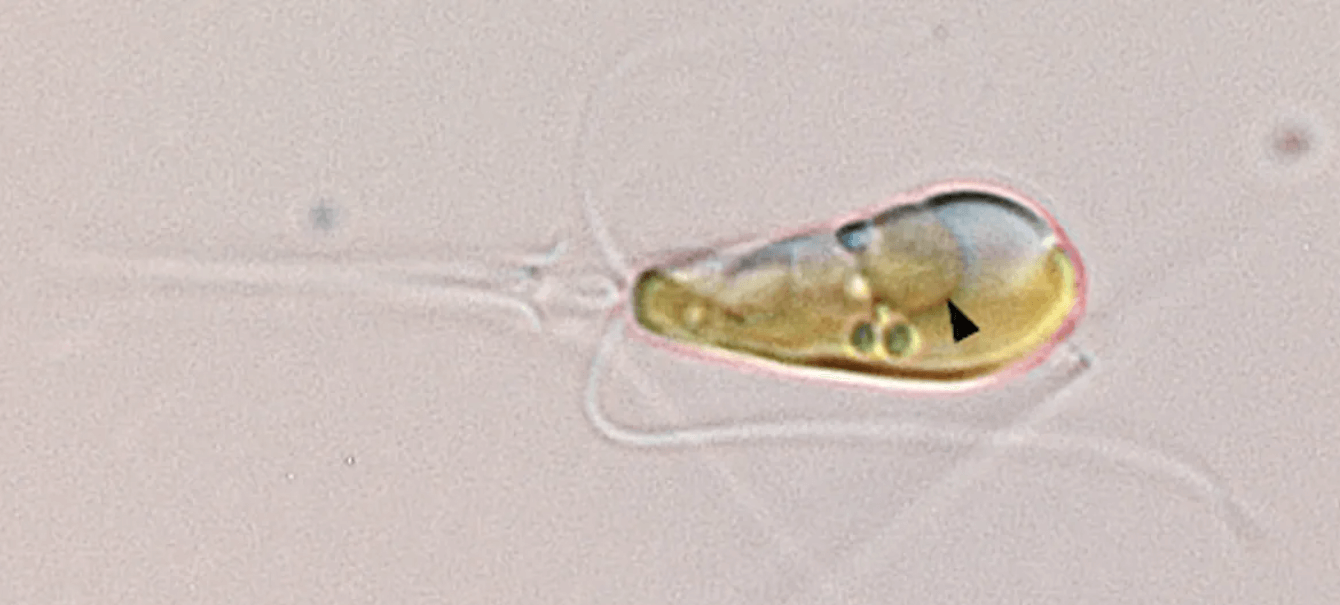 На Земле снова зародилась жизнь. Клетка морской водоросли с новой органеллой нитропластом (указана срелочкой). Фото.