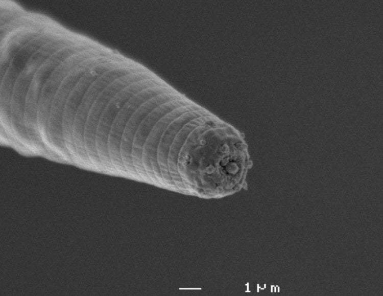Самые глубоко живущие черви. Дьявольский червь под микроскопом. Изображение: 22century.ru. Фото.