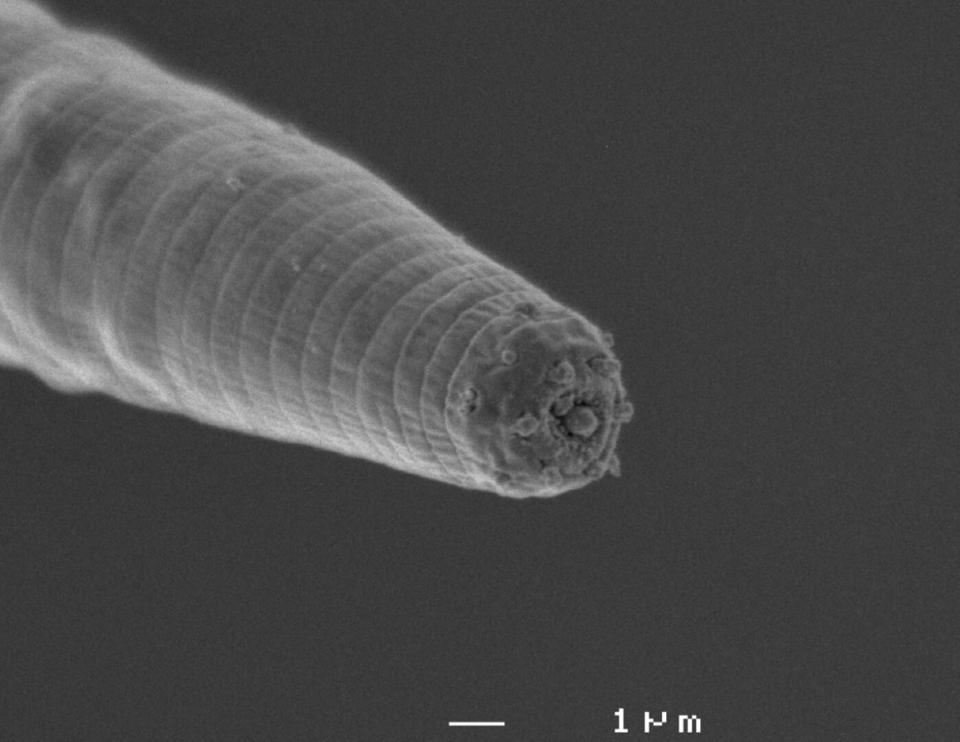 Самые глубоко живущие черви. Дьявольский червь под микроскопом. Изображение: 22century.ru. Фото.