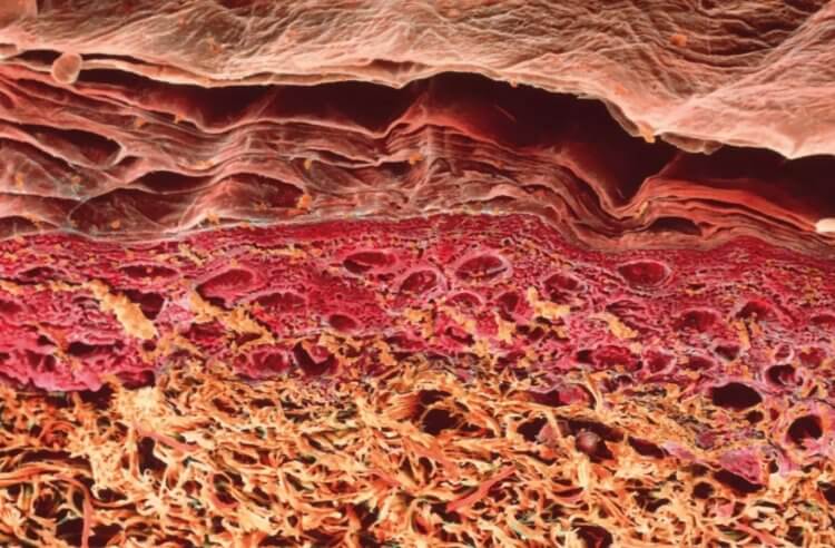 人間の体にはどれくらいの細菌が存在するのでしょうか？ 顕微鏡で見た人間の皮膚の断面図。 画像出典：sciencephoto.com 写真。