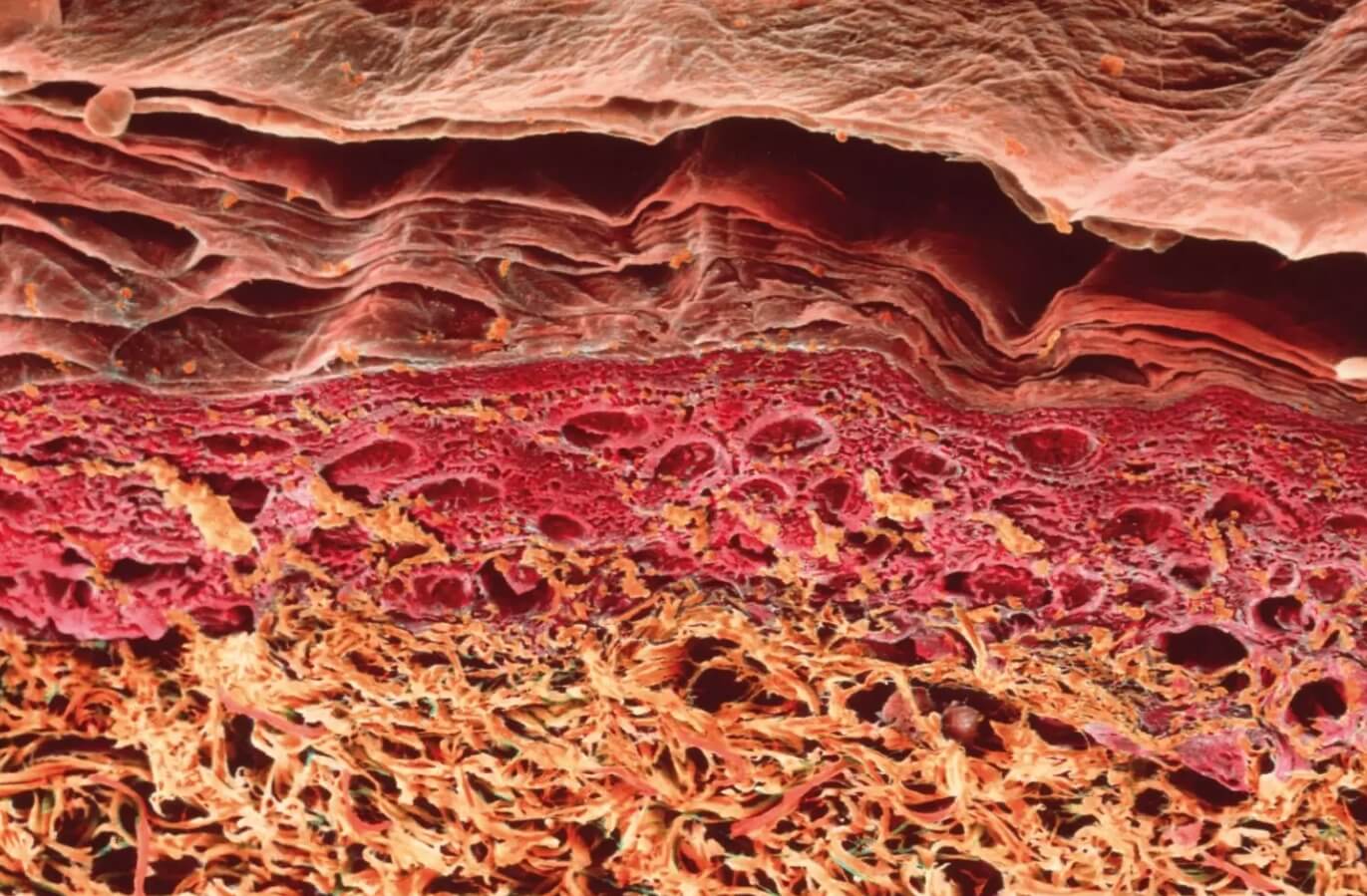 Сколько бактерий на теле человека. Поперечный срез кожи человека под микроскопом. Источник изображения: sciencephoto.com. Фото.