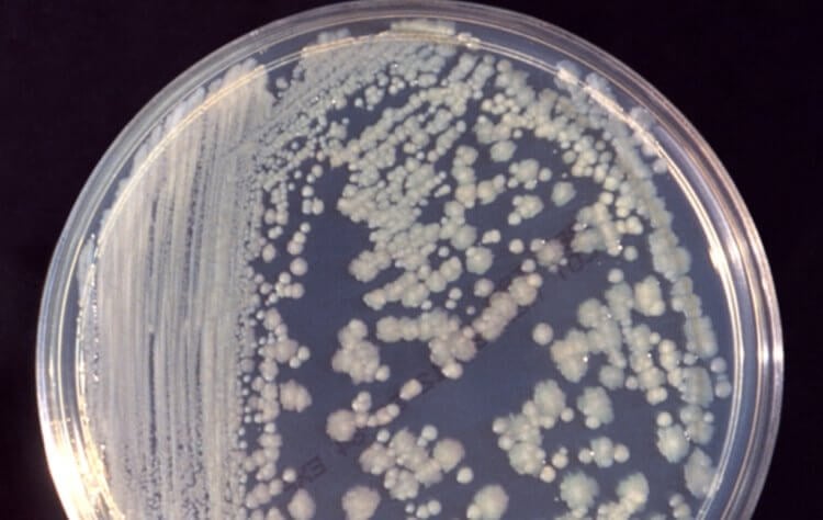 抗生物質耐性菌。 ペトリ皿の中のエンテロバクター菌。 写真出典: wikimedia.org 写真。
