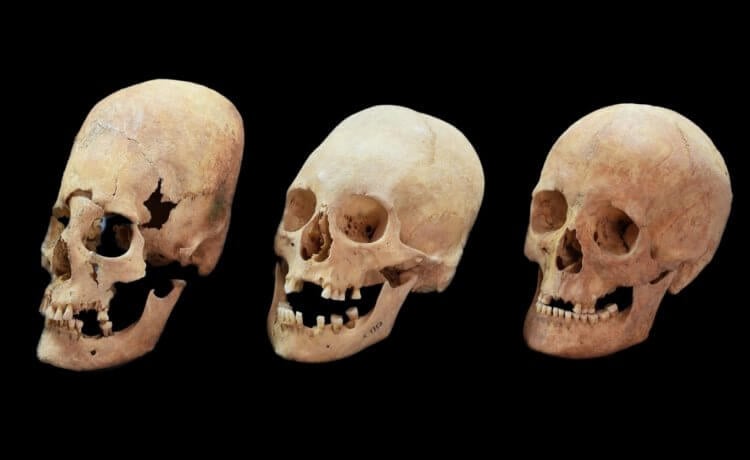 Changes in the shape of the Viking skull. In ancient times, skull deformation was common. Image source: scientificrussia.ru. Photo.