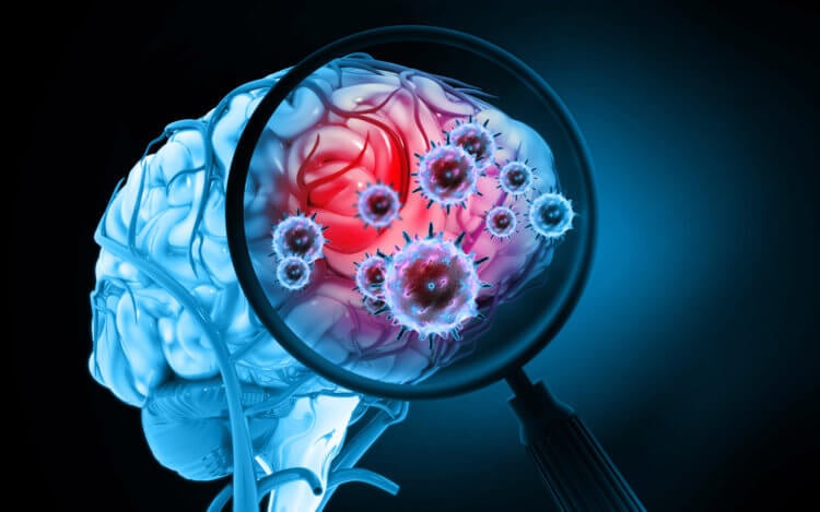 Hjernevidenskab: Zombieceller hjælper ikke mus med at lære. Billede: d.newsweek.com. Foto.