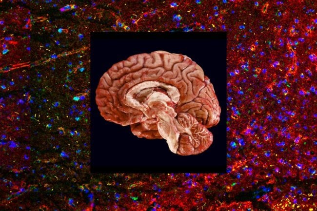 Что такое зомби-нейроны и как они помогают мозгу учиться? Фото.