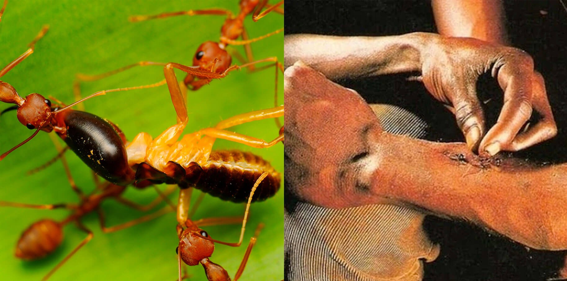 Как африканские племена зашивают раны при помощи муравьев