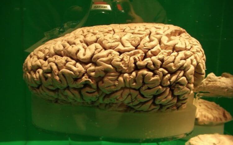 Den största hjärnan bland djur. Kaskelotens hjärna. Fotokälla: neuronovosti.ru. Foto.