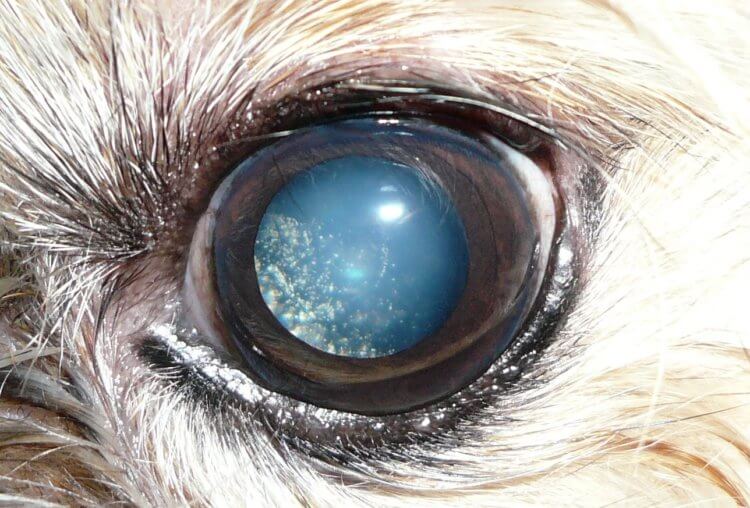 Звезды перед глазами человека. Также астероидный гиалоз встречается у собак и других животных, что делает болезнь еще более загадочной. Источник фотографии: sciencealert.com. Фото.
