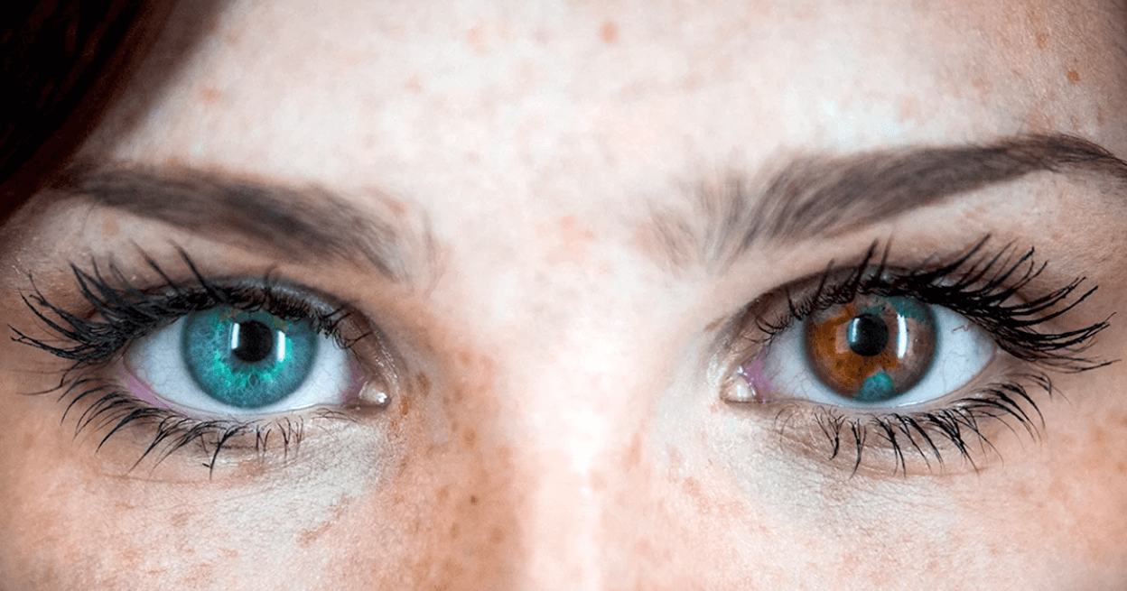 Почему глаза бывают разного цвета. Гетерохромия встречается у 1% населения планеты. Источник фото: twam.ru. Фото.