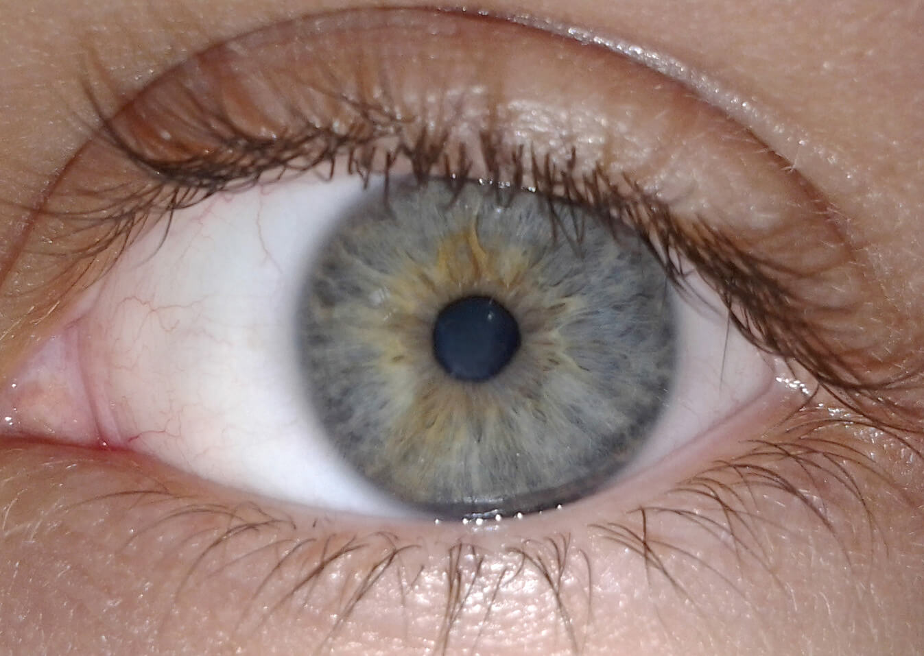 Почему глаза человека имеют цвет. Голубой цвет глаз связан с низким уровнем пигмента зумеланина. Источник фото: wikipedia.org. Фото.