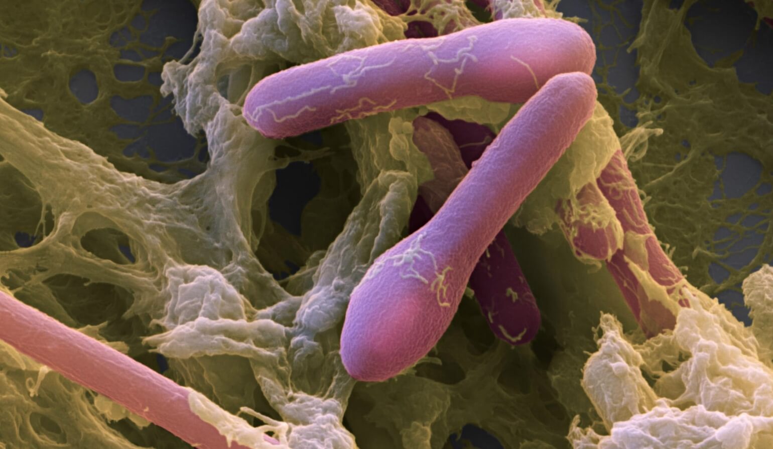 Самый смертельный яд в мире. Выделяемый бактериями ботулотоксин вызывает у человека ужасные недомогания. Источник: fineartamerica.com. Фото.