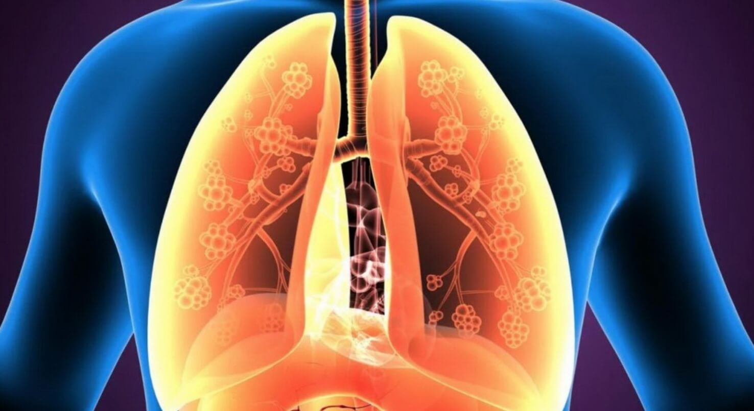 Приступ астмы начинается не на ровном месте — всегда есть провоцирующий фактор. Источник изображения: 1rkb.ru. Фото.