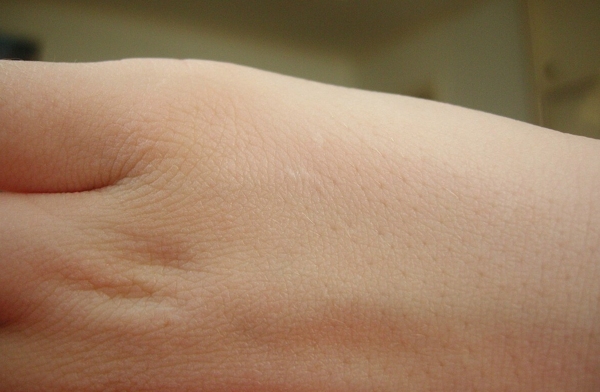 Кожа играет некоторую роль в дыхании, но очень маленькую. Источник изображения: wikipedia.org. Фото.