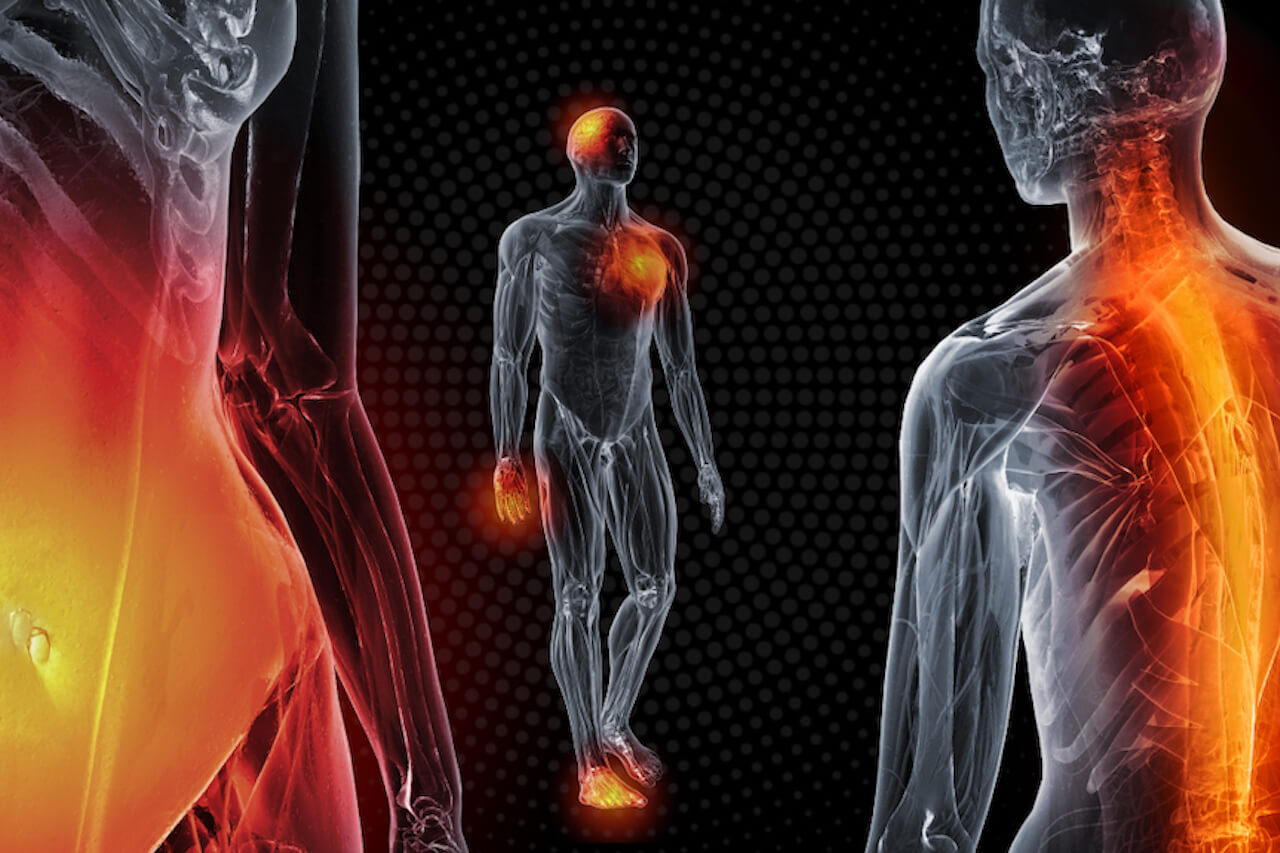 Как недостаток сна влияет на иммунитет. После недосыпа в организме начинаются воспалительные процессы. Источник: violapharm.com. Фото.