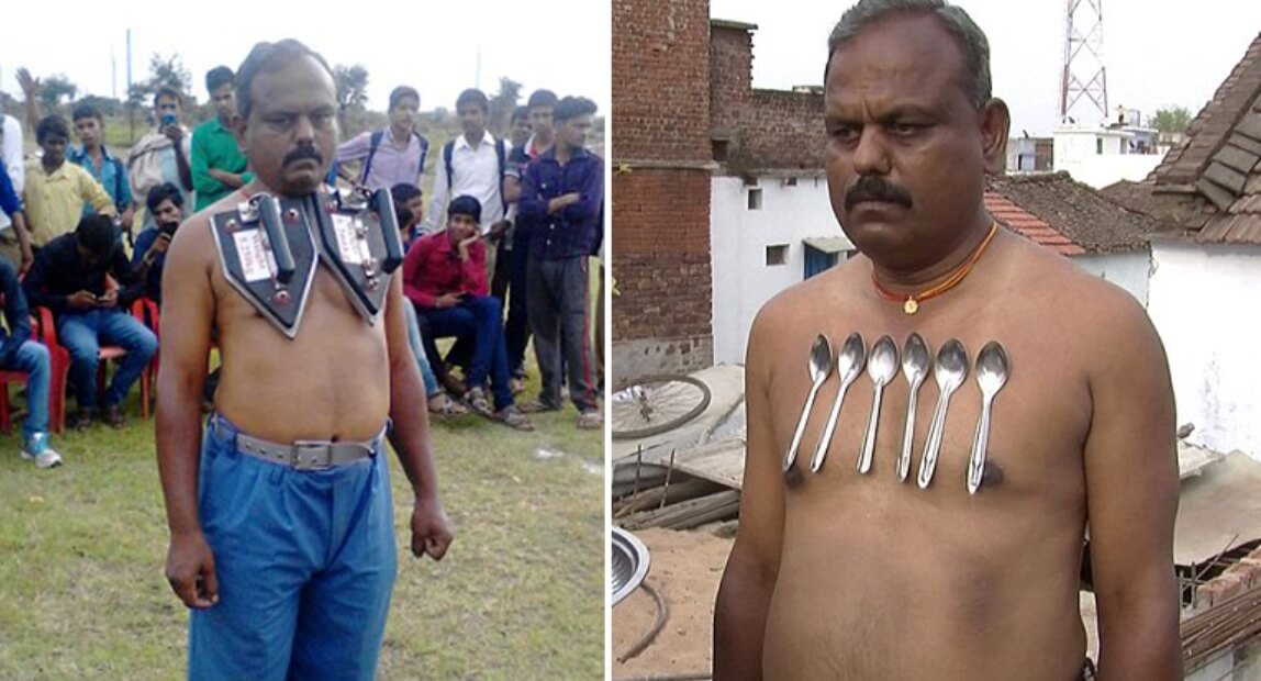 У людей-магнитов на теле всегда отсутствует волосяной покров. Источник: fishki.net. Фото.