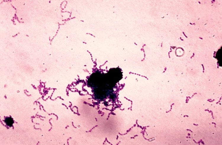 Новая защита от кариеса. Streptococcus mutans — бактерии, которые участвуют в образовании кариеса. Источник изображения: wikipedia.org. Фото.
