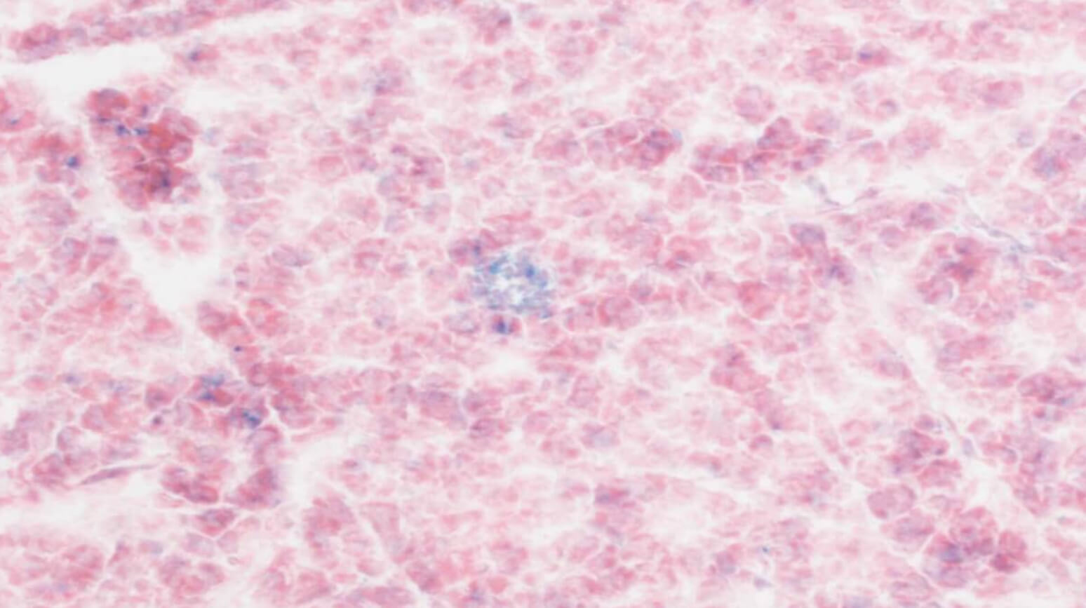 Старые клетки (синие) с возрастом накапливаются и «заражают» соседние клетки. Фото.