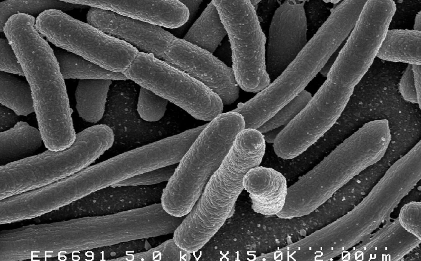 Почему нельзя сочетать кофе и антибиотики. Кишечная палочка под микроскопом. Источник изображения: wikimedia.org. Фото.