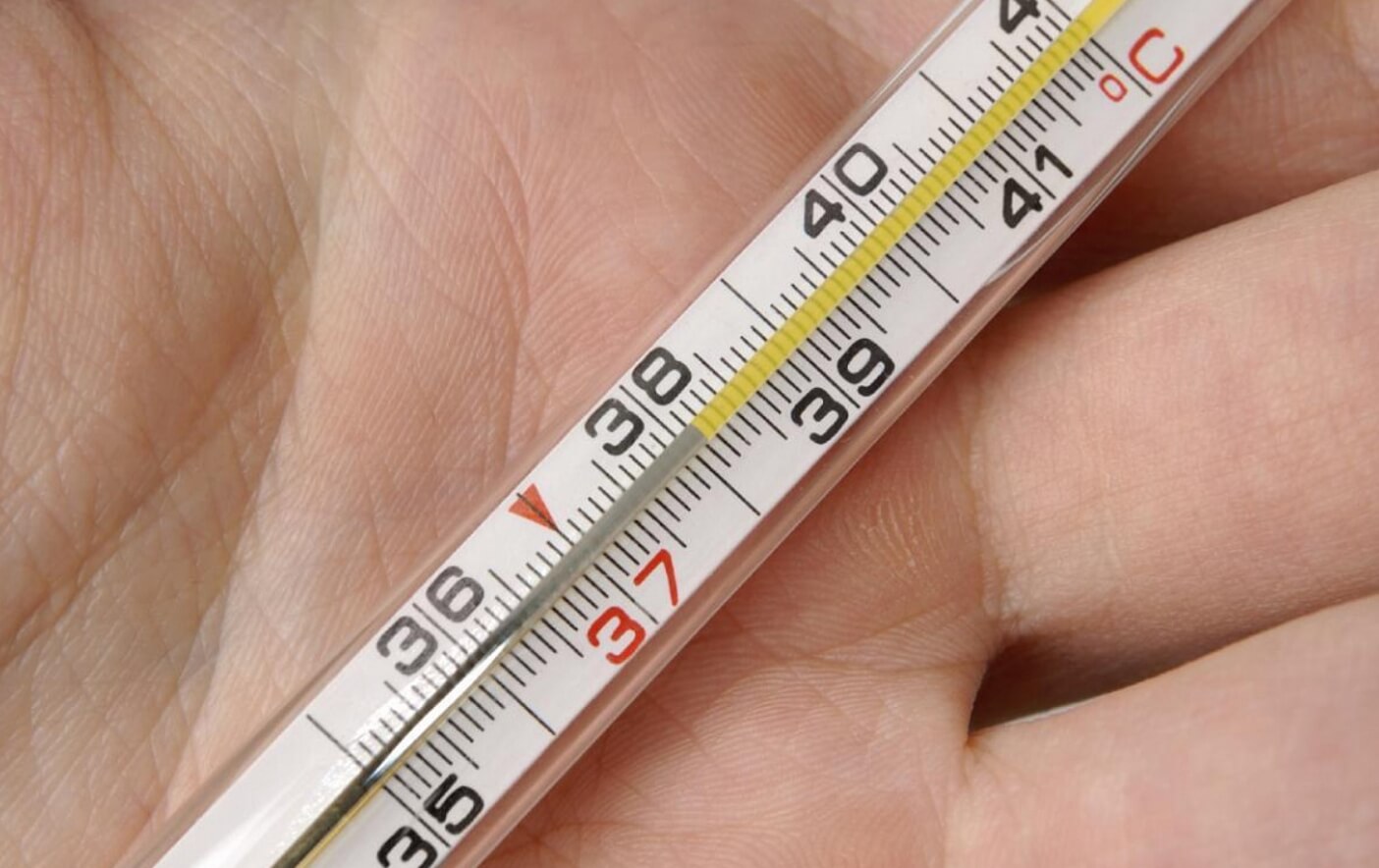 Симптомы и признаки лихорадки чикунгунья. Вирус чикунгунья сильно поднимает температуру тела. Источник фотографии: yagazeta.com. Фото.