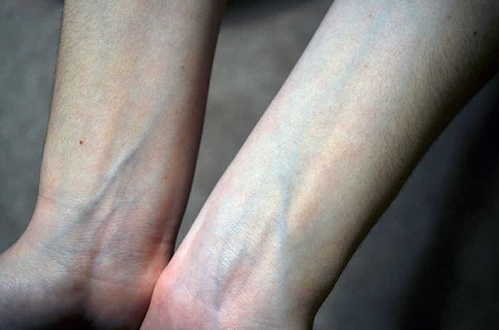 Кровь всегда красная: миф о синей крови. Вены не являются синими сами по себе, их цвет — это иллюзия, связанная с тем, как свет взаимодействует с кожей и тканями. Источник изображения: aminoapps.com. Фото.