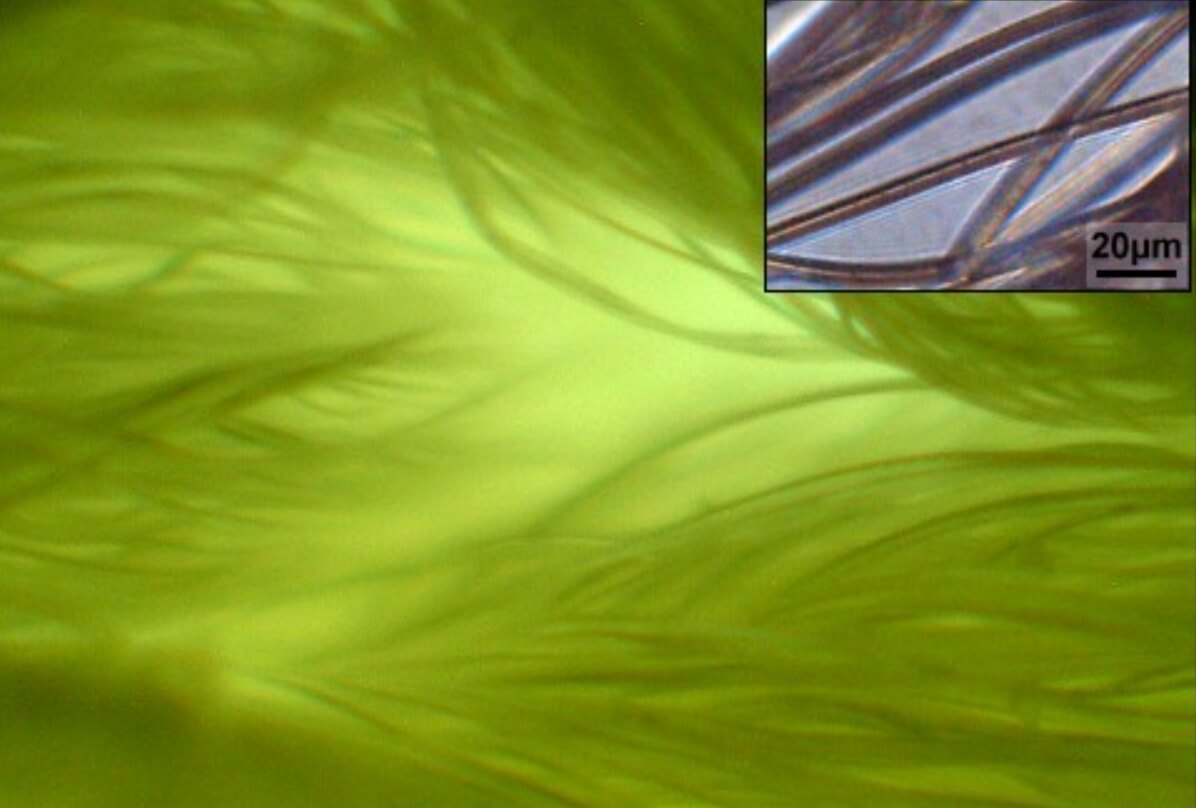 Что такое салфетка из микрофибры и как она работает. Микрофибра под микроскопом. Источник изображения: wikipedia.org. Фото.