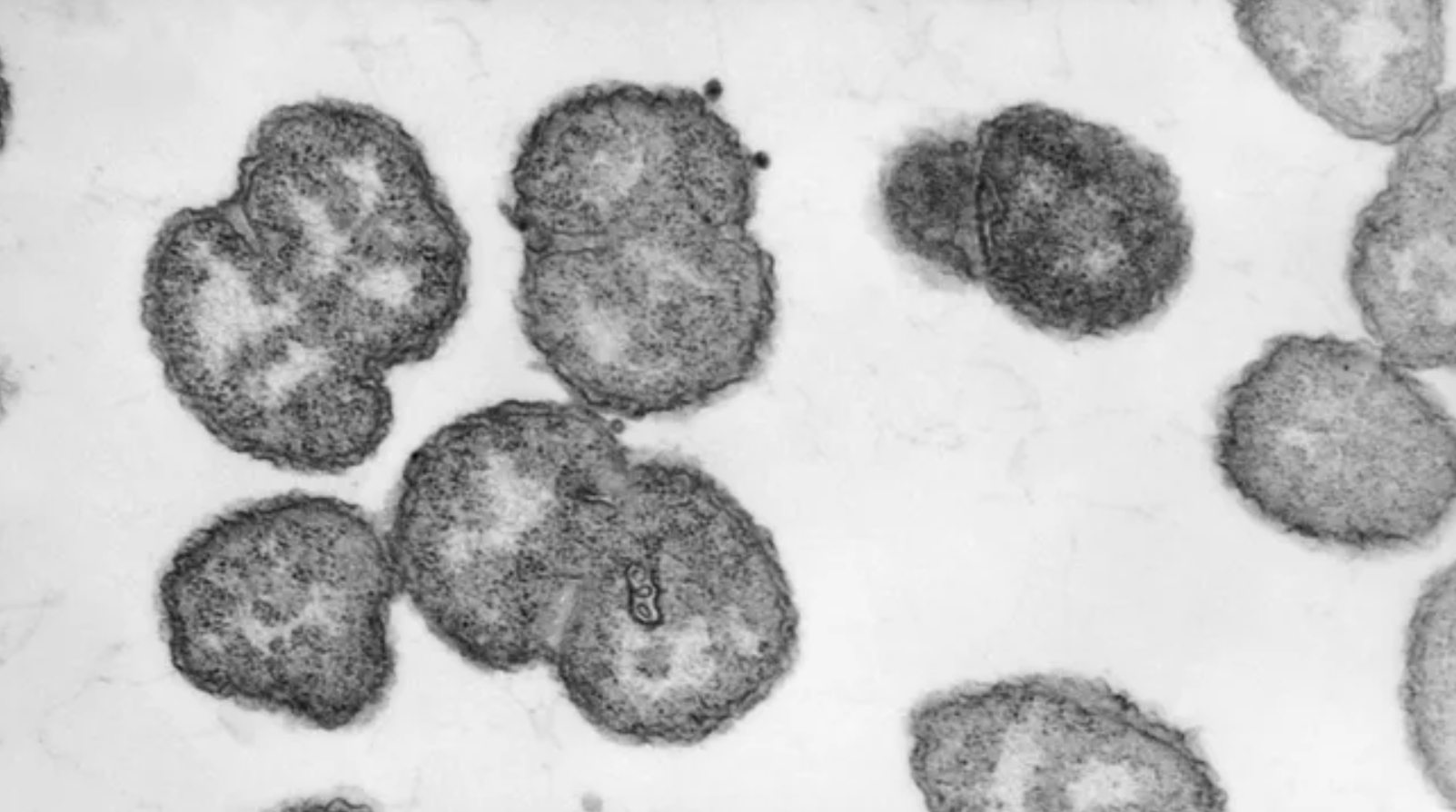 Бактерии Neisseria gonorrhoeae под микроскопом. Источник изображения: Live Science. Фото.