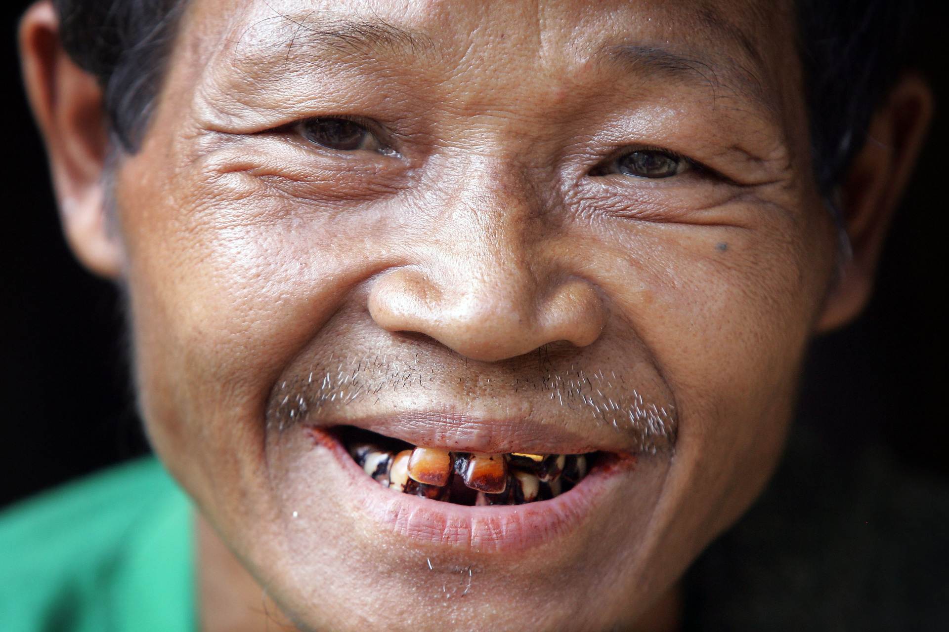 Польза и вред опьяняющего ореха. В результате постоянного потребления ореха бетеля окрашиваются зубы и слизистая рта. Источник: russian.rt.com. Фото.