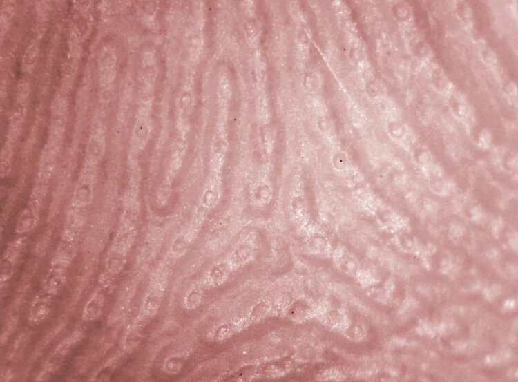 Почему воняют подмышки. Поры потовых желез на подушечке пальца человека. Источник изображения: wikimedia.org. Почему воняют подмышки. Поры потовых желез на подушечке пальца человека. Источник изображения: wikimedia.org. Фото.