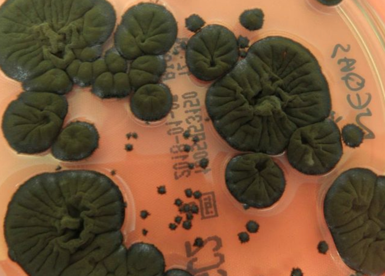 Грибок, растущий за счет радиации. Источник изображения: sciencealert.com. Фото.