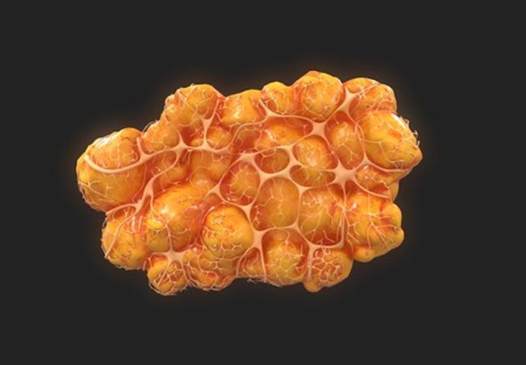 Как будут лечить ожирение. Жировые клетки даже по одной смотрятся некрасиво. Изображение: TurboSquid. Фото.