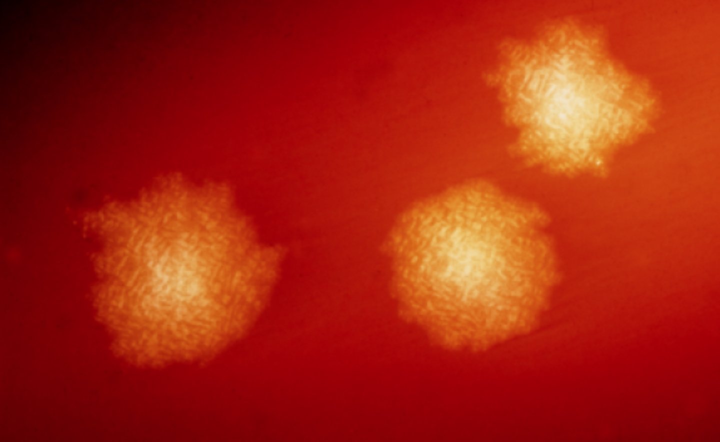 Бактерии Clostridium difficile. Источник изображения: wikimedia.org. Фото.