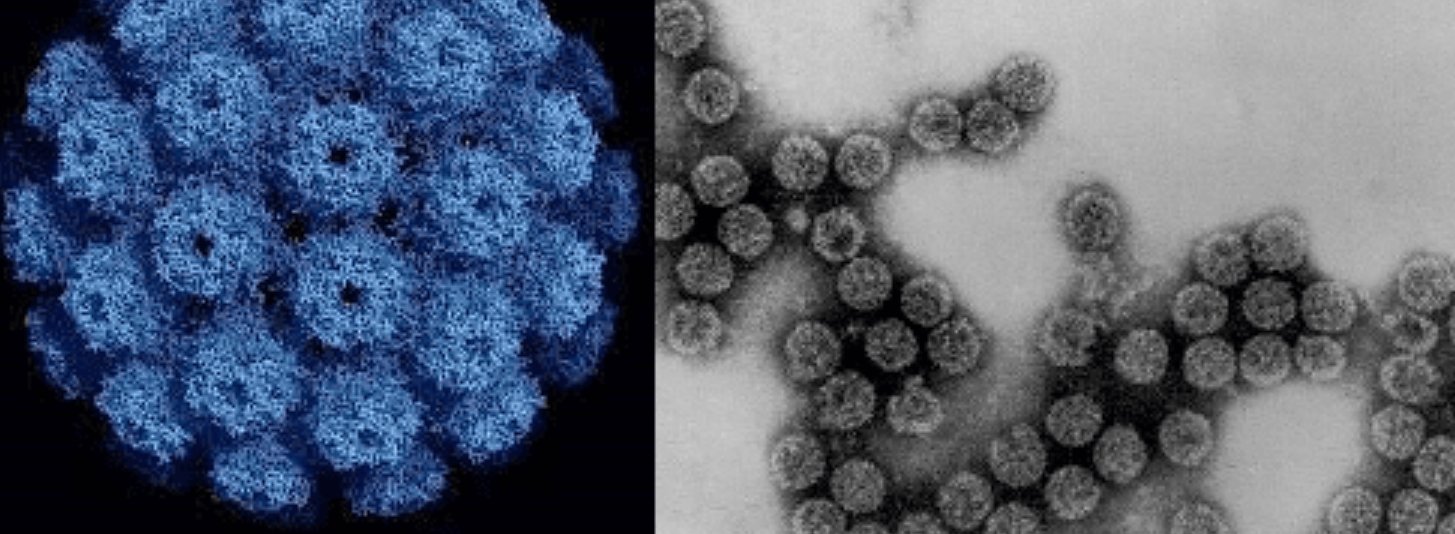 Полиомавирусы под микроскопом. Источник изображения: microbiologyclass.net. Фото.